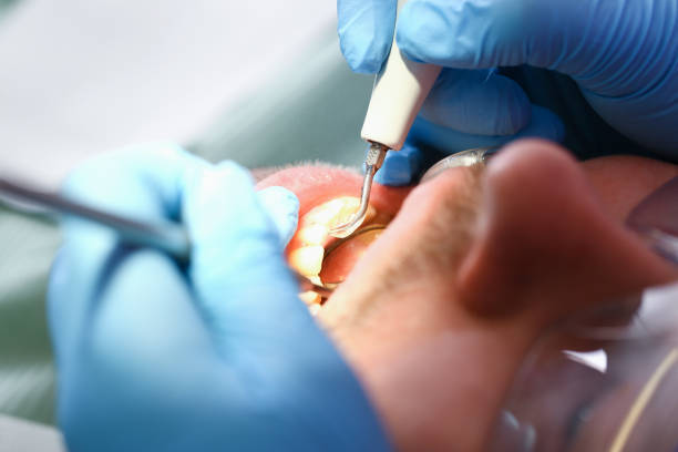 Best Emergency Treatment for Oral Infections in Victoria, KS