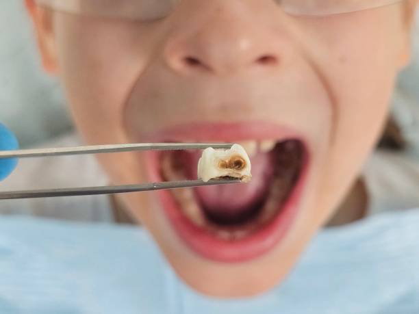 Best Walk-In Emergency Dental Services in Victoria, KS